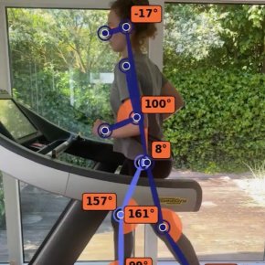 Loopanalyse